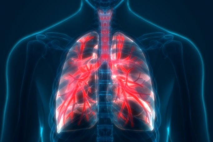 Bệnh phổi tắc nghẽn mạn tính (COPD)
