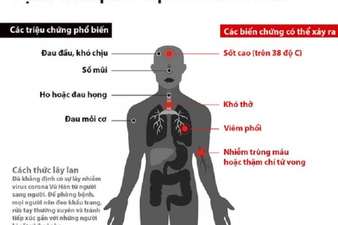 Bệnh viêm phổi cấp từ Virut Corona